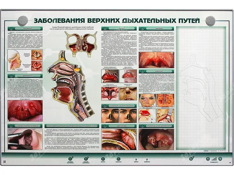 Стенд Зарница заболевания верхних дыхательных путей